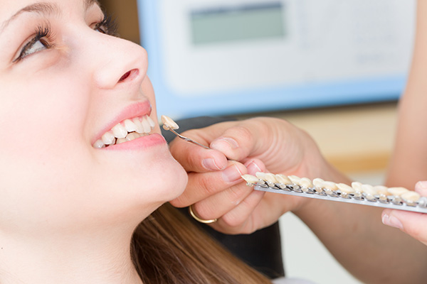 General Dentistry: Can Dental Veneers Help Restore Your Teeth? from Miami Smile Dental in Miami, FL