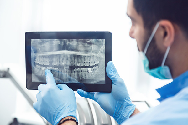 General Dentistry: Are Dental X-rays Recommended? from Miami Smile Dental in Miami, FL